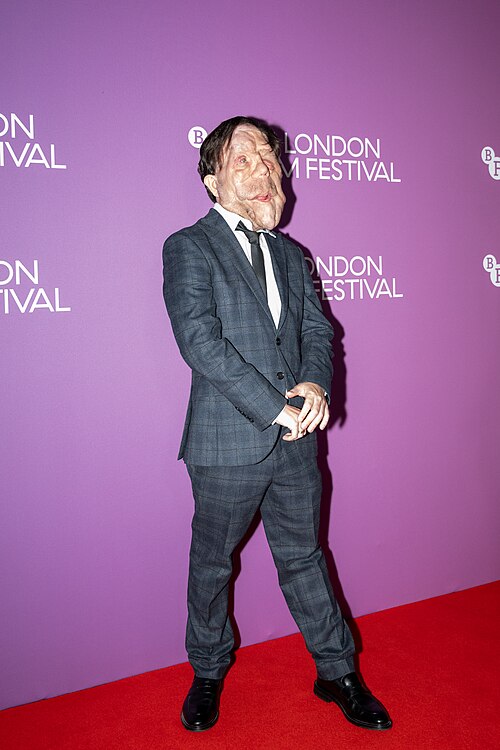 Adam Pearson attending the premiere of Zero Intention Of Living Quietly at the 70th BFI London Film Festival, at Vue Cinema Leceister Square, 11th of October 2026