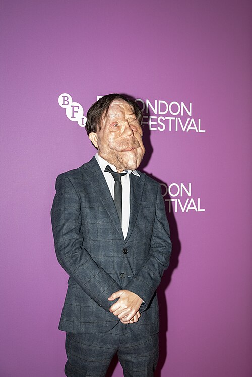 Adam Pearson attending the premiere of Zero Intention Of Living Quietly at the 70th BFI London Film Festival, at Vue Cinema Leceister Square, 11th of October 2026